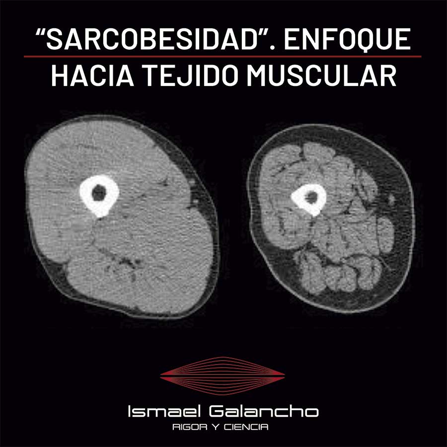 SARCOBESIDAD-900×900