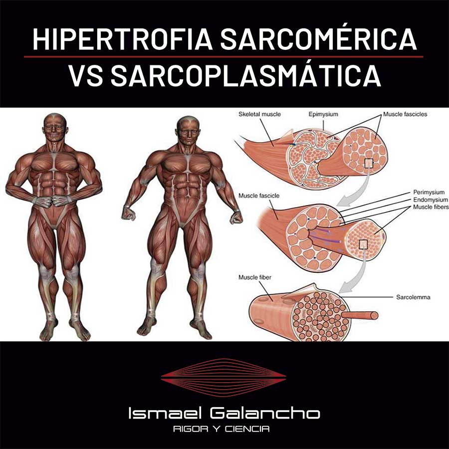 Hipertrofia sarcomérica y sarcoplasmática