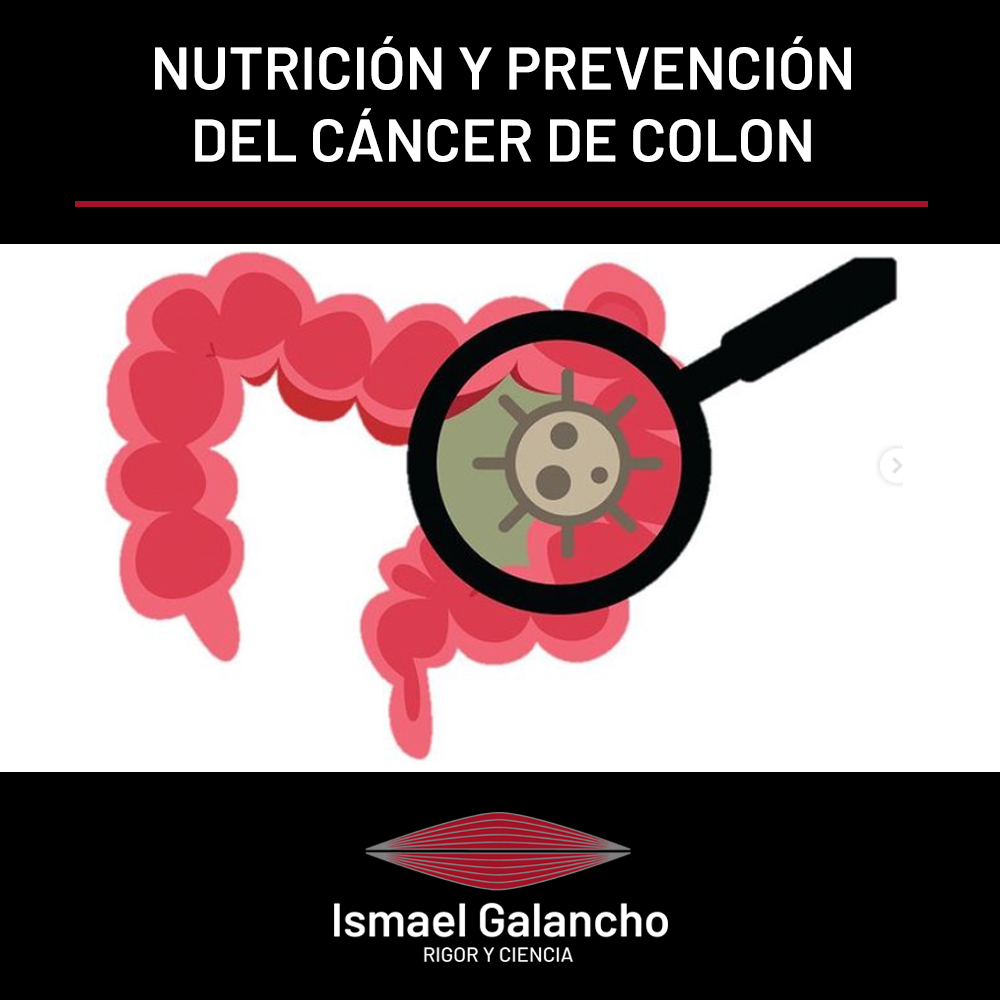 Nutrición y prevención del cáncer de colon