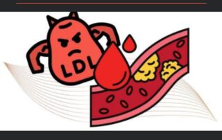 Colesterol LDL y riesgo ateroesclerosis