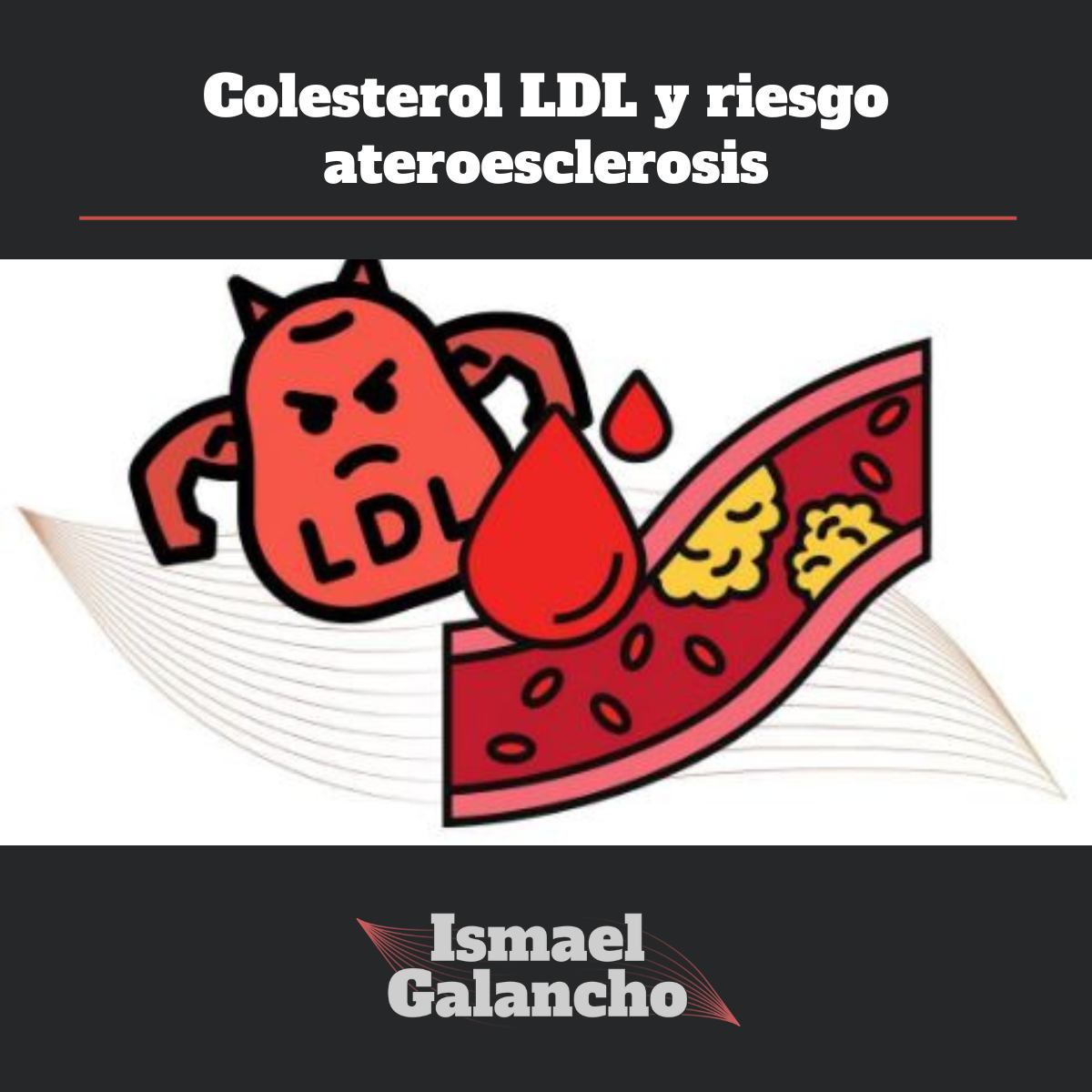 Colesterol LDL y riesgo ateroesclerosis