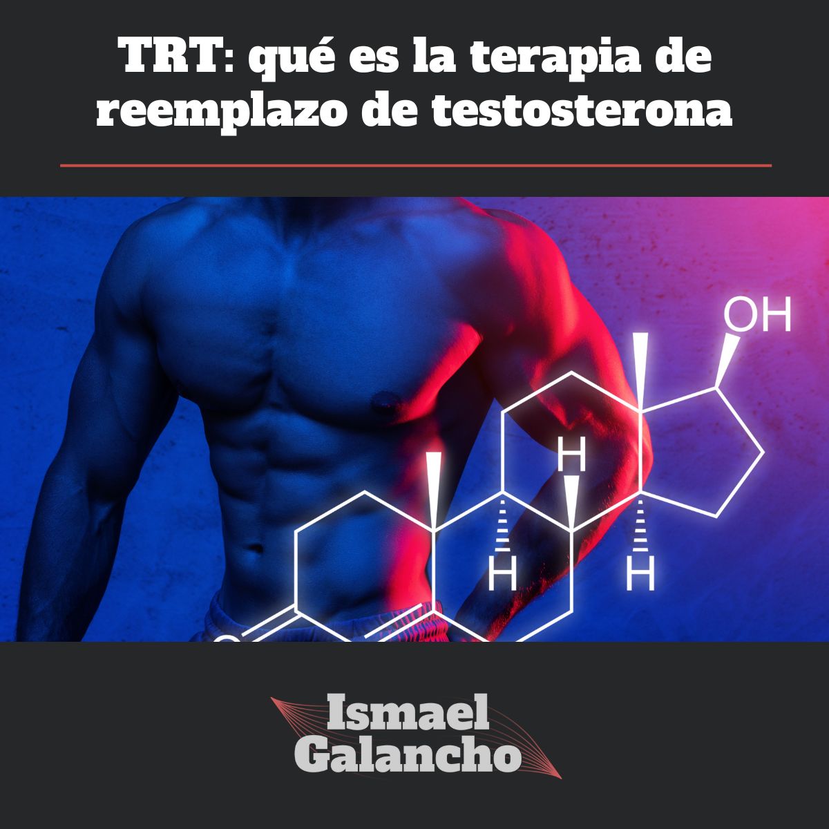 TRT Artículo Blog Ismael Galancho