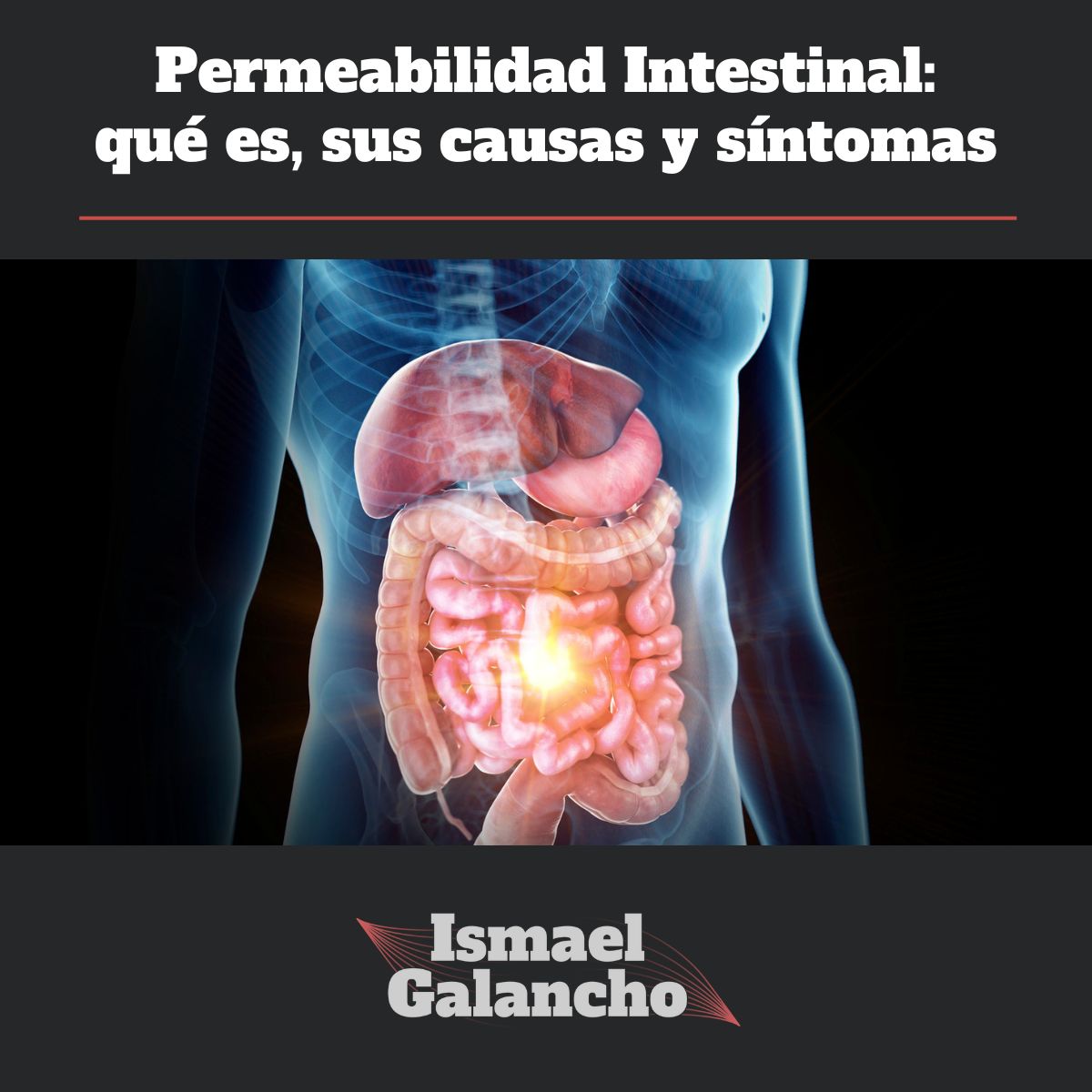 Permeabilidad intestinal