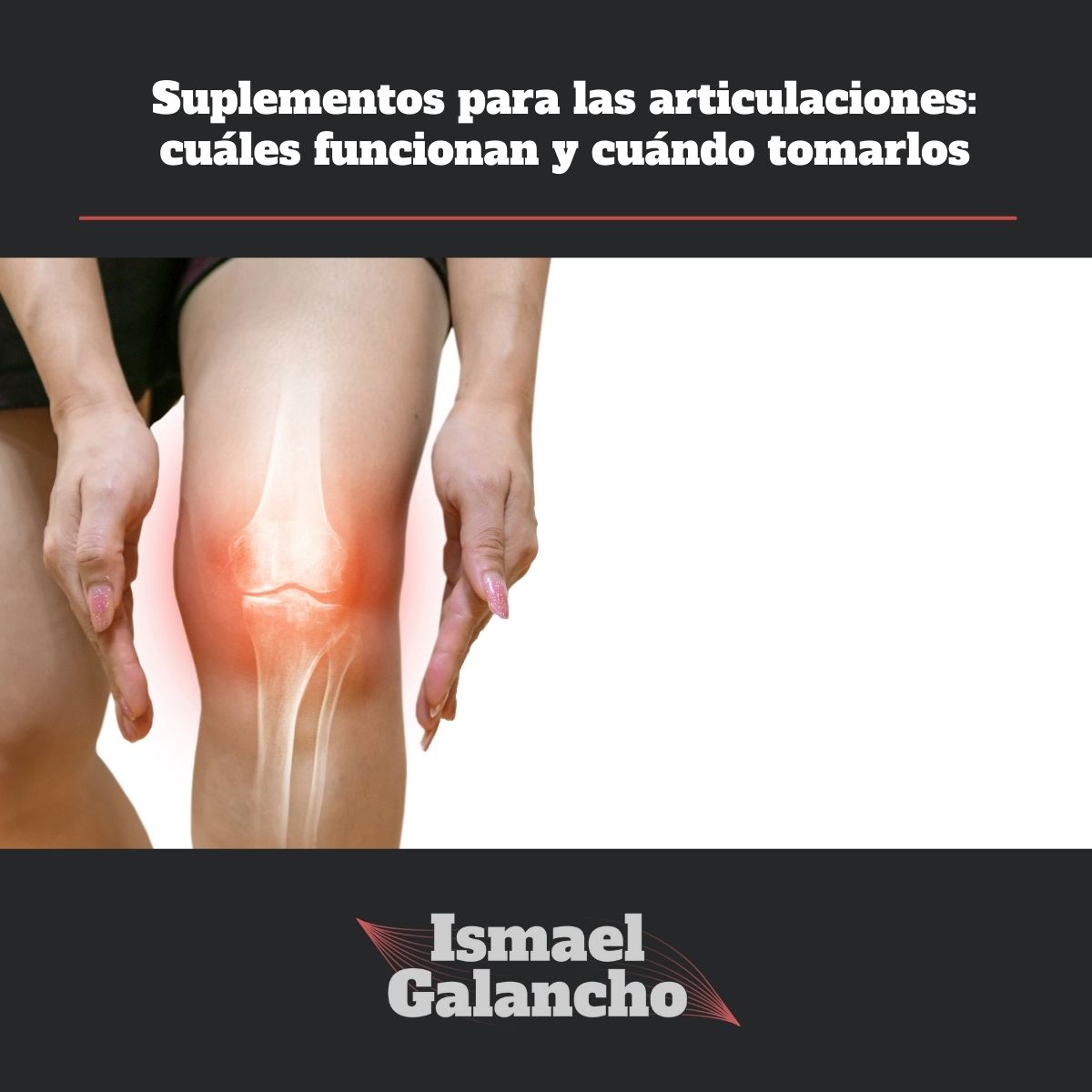 suplementos para las articulaciones